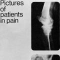 Pictures of Patients in Pain folder