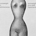 In “extra problem” patients…, leaflet