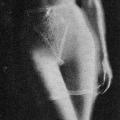 “Why do men who hate girdles…”