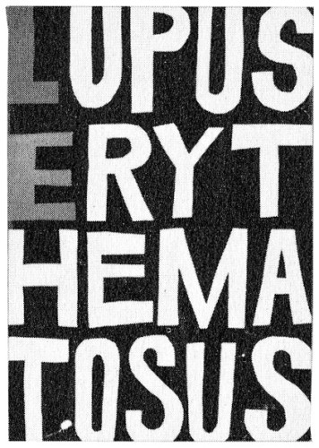 Lupuserythematosus (One page in House Magazine)