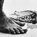 “Ankle-it is”