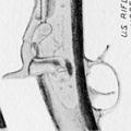 From Flintlock to M1