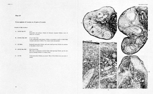 Embryology of the Ovary and Testis